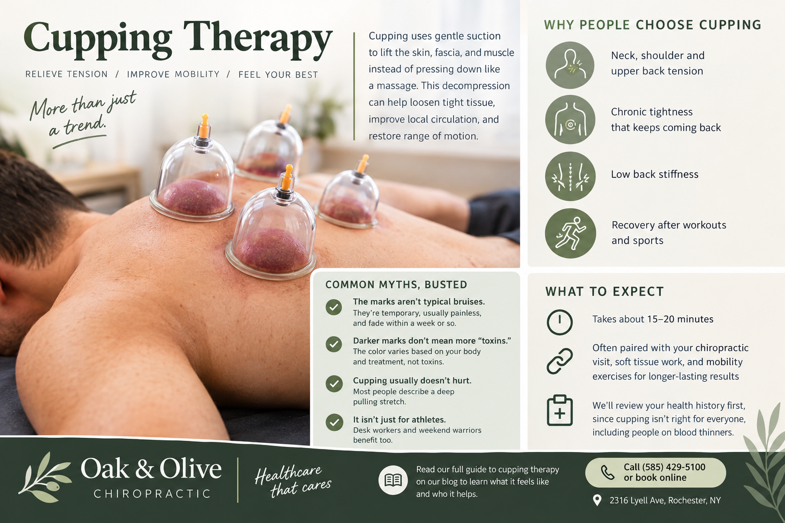 Cupping therapy infographic showing glass cups on a patient's back, with common reasons people choose cupping, four myths busted, and what to expect at Oak & Olive Chiropractic in Rochester, NY